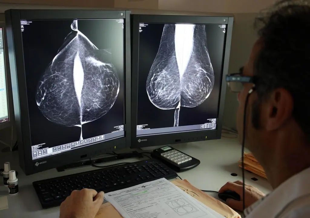 Estudio de una mamografía digital, en el servicio de mamografías del Hospital Río Hortega de Valladolid. Foto: Rubén Cacho.