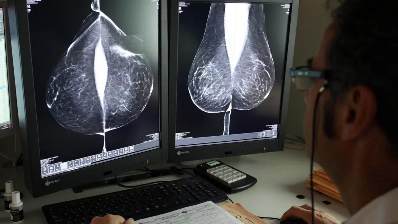 Estudio de una mamografía digital, en el servicio de mamografías del Hospital Río Hortega de Valladolid. Foto: Rubén Cacho.