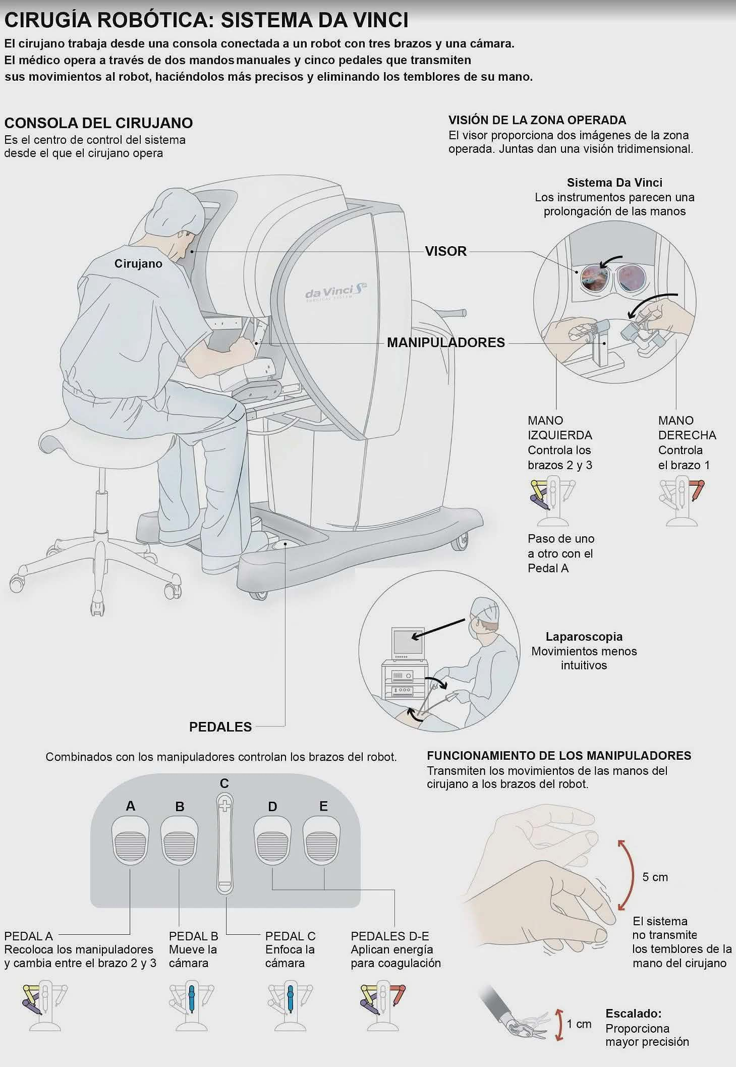 Puesto del médico para el uso del robot Da Vinci.